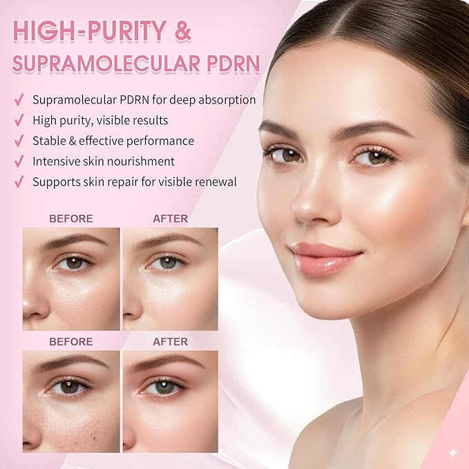 Salmon DNA PDRN Serum,99% Salmon DNA PDRN Ampoule,Anti-wrinkle, Anti-aging, Brightening, Moisturizing and repairing with Collagen, Glutathione, Hyaluronic Acids & Snail Serum,0.05 fl.oz x 30e