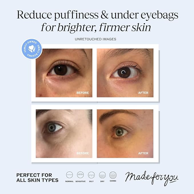 Lilyana naturals eye cream -