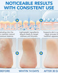 Urea Foot Care Stick, 60% Urea with 2% Salicylic Acid Foot Cream Moisturizer for Dry Cracked Feet, Knees, Elbows, Hands, Moisturizes and Hydrates the Dry Skin, Callus Remover & Skin Softener 1.41 oz