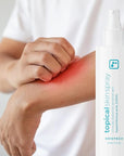 BRIOTECH Topical Skin Spray, Hypochlorous Acid Spray for Sensitive Skin, HOCl Facial Mist, Full Body Support Against Irritation, Calm Redness, Soothe Foot & Scalp, 8 oz (1 Pack)