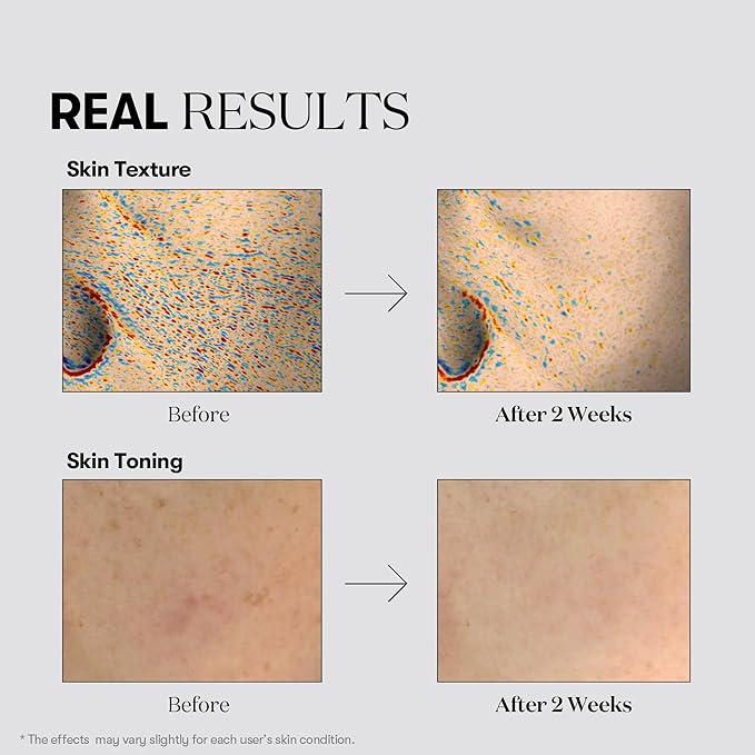 VT COSMETICS TX Toning Daily Mask 30 Sheets, Tranexamic Acid, Niacinamide, Glutathione for Acne Scars, Dark Spots, Sun Spots, Hydrating & Glowing Facial Mask, Fragrance-Free, Korean Face Mask