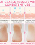 Heel Balm for Dry Cracked Feet (Peach), Urea Cream 60% Foot Balm Stick for Cracked Heel Repair - Moisturizes, Exfoliates, and Softens Dry, Thickened Skin, Callus Remover for Feet