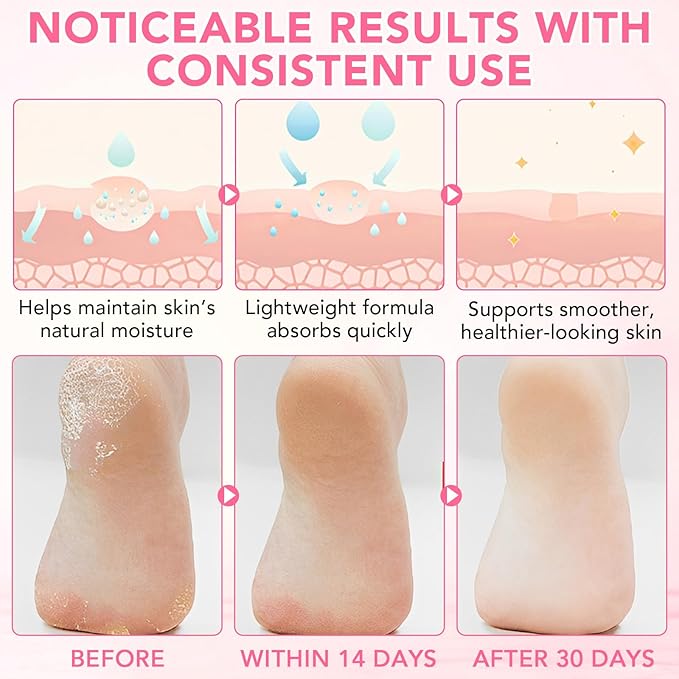 Heel Balm for Dry Cracked Feet (Peach), Urea Cream 60% Foot Balm Stick for Cracked Heel Repair - Moisturizes, Exfoliates, and Softens Dry, Thickened Skin, Callus Remover for Feet