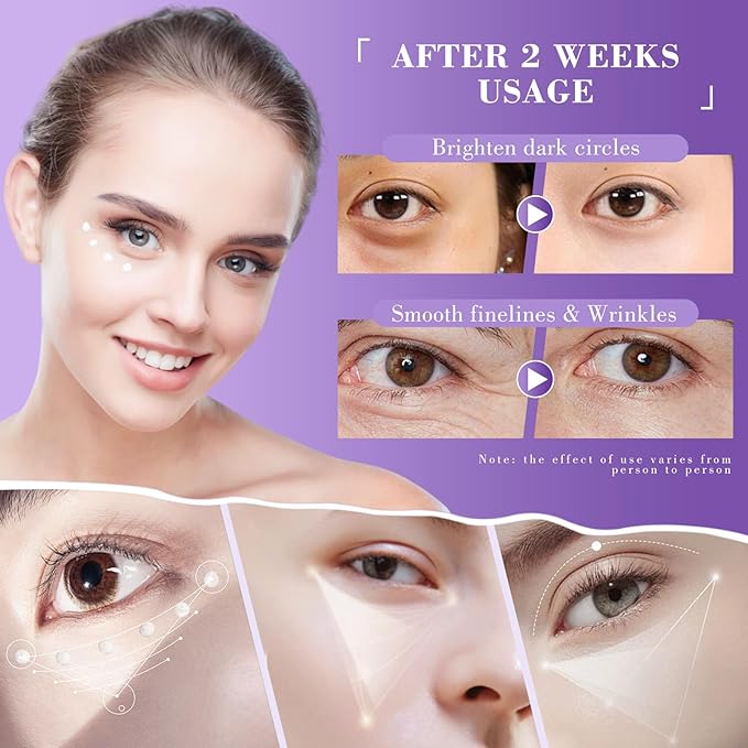 Eye Cream, Retinol Eye Cream for Dark Circles, Puffiness Anti Aging, With Hyaluronic Acid, Peptides, Caffeine Reduces Bags, Smooths Wrinkles & Fine Lines, Dark Circles Under Eye Treatment