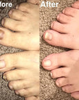 Probelle Natural Fungal Nail Oil,