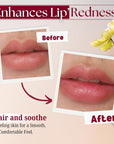 Merlena Pink Lip & Nip Serum - Hydrates and Repairs Dry, Peeling Lips and Nipples, Adds Collagen for Plumpness, Soothes Flaky Skin, Organic Vitamin C & E Formula 8ml