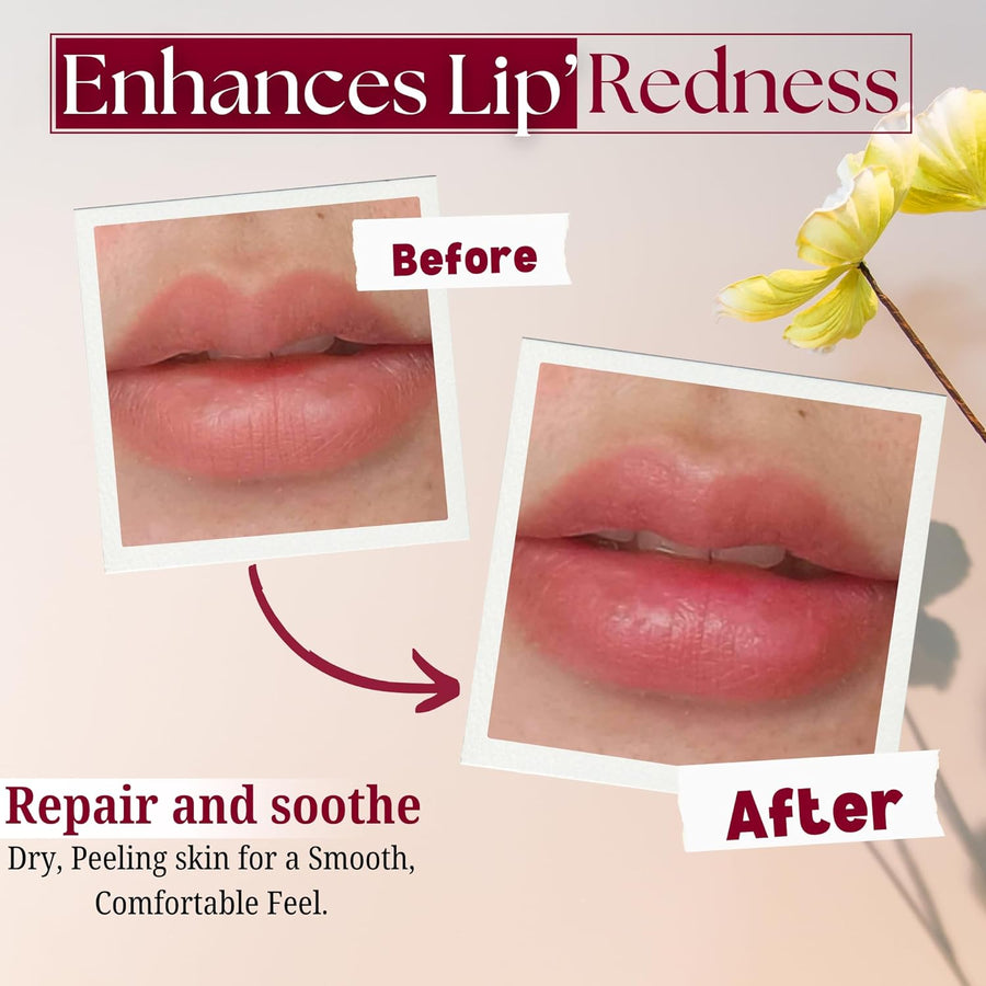 Merlena Pink Lip & Nip Serum - Hydrates and Repairs Dry, Peeling Lips and Nipples, Adds Collagen for Plumpness, Soothes Flaky Skin, Organic Vitamin C & E Formula 8ml