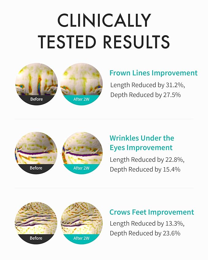 REJURAN® Intensive Eye Cream, c-PDRN® - Fast-Acting Eye Treatment for Wrinkles, Lifting, and Dark Circles. Instant Hydration and Visible Revitalization. Korean Skin Care (0.67 fl oz)