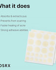 COSRX Acne Pimple Patch Absorbing Hydrocolloid Original 3 Size Patches for Blemishes and Zits Cover, Spot Stickers for Face and Body, Not Tested on Animals
