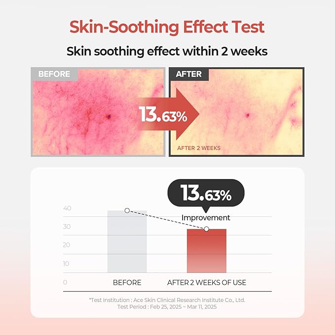 SKINFOOD Peach Cotton Zinc PCA Toner Pads, Korean Skincare for Dual Functional Hydrating,Soothing & Matte, Velvety Finish, Stocking Stuffers, Sebum Control for Sensitive, Oily, 5.64 oz (70 Pads)