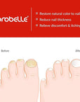 Probelle Natural Fungal Nail Oil,
