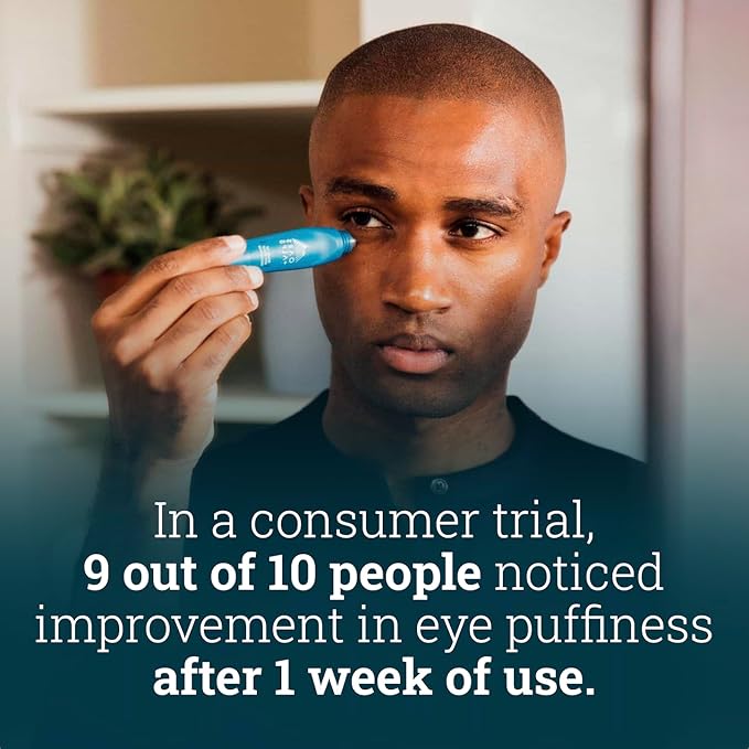 Oars + Alps Wake Up Under Eye Roller and Eye Depuffer, Dermatologist Tested Skin Care Infused with Caffeine and Aloe Vera, Soothes, Reduce Fine Lines, Refreshes Face, 0.5 Oz