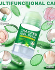 Heel Balm for Dry Cracked Feet (Aloe Vera), Urea Cream 60% Foot Balm Stick for Cracked Heel Repair - Moisturizes, Exfoliates, and Softens Dry, Thickened Skin, Callus Remover for Feet