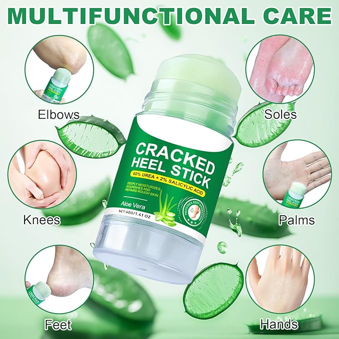 Heel Balm for Dry Cracked Feet (Aloe Vera), Urea Cream 60% Foot Balm Stick for Cracked Heel Repair - Moisturizes, Exfoliates, and Softens Dry, Thickened Skin, Callus Remover for Feet