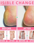Urea Cream 60% Plus Salicylic Acid 2% Foot Balm Stick for Dry Cracked/Chapped Heel, Skinned knees, Hand Intensively Hydration/Moisturization, Callus Removal/Softening/Soothing-Peach Scent|1.41 Oz/40 G