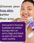 AmLactin KP Bumps Be Gone - 3 oz Keratosis Pilaris Moisturizing Cream with 15% Lactic Acid - Exfoliator and Moisturizer for Dry, Rough and Bumpy Skin (Packaging May Vary)