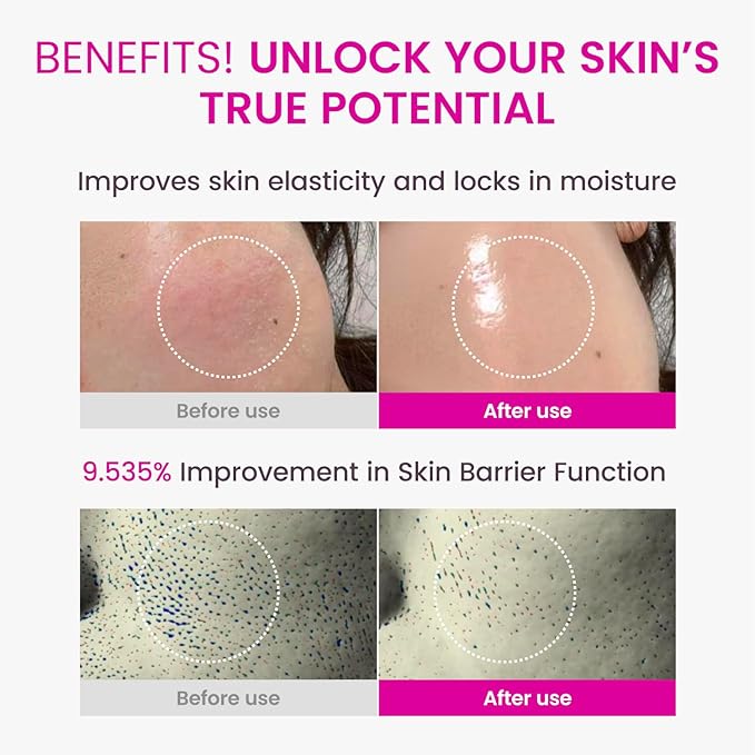 YADAH Collagen Hydra Core Cream - Barrier Repair Moisturizer with 10 Types of Hyaluronic Acids, 1000ppm Low Molecular Collagen (Capsule) & Creamide, Deep Hydration for Sensitive Skin, 1.76 oz