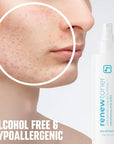 BRIOTECH Skin Renew Toner, Hypochlorous Acid Spray Topical Skin Spray for Face and Skin, Minimize Appearance of Blemishes, Soothing Mist for Redness & Bumps, 4 fl oz