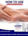 Urea Cream 40 Percent for Feet Maximum Strength – Foot Callus Remover Cream Plus 2% Salicylic Acid for Dry, Cracked Heels and Feet Repair, 3.4 oz