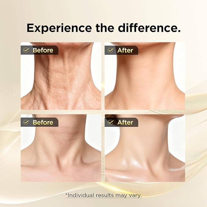 Neck Cream - Retinol & Collagen Neck Firming Cream for Wrinkles, Moisturizing and Anti-Aging, Perfect for Neck & Décolleté Skin Care - 1.7 fl.oz