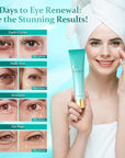 Advanced Eye Cream for Dark Circles - Rapid Under Eye Bags,Wrinkles, Puffiness Remover for Women and Men - Temporary Firming & Tightening Treatment - Wrinkle Filler 1 oz