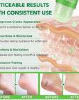 Urea Cream 60% Plus Salicylic Acid 2% Foot Balm Stick for Dry Cracked/Chapped Heel, Skinned knees, Hand Intensively Hydration/Moisturization, Callus Removal/Softening/Soothing-Aloe Scent|1.41 Oz/40 G