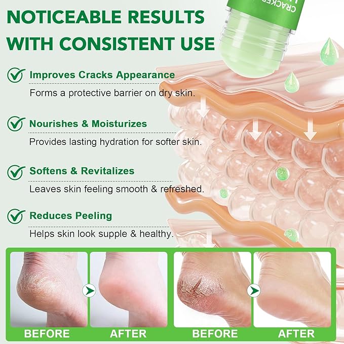 Urea Cream Stick 60% plus Salicylic Acid 2%, Maximum Strength Urea Foot Cream for Dry Cracked Feet, Knees, Elbows, Hands, Exfoliating Dead Skin, Softening Skin (1 PC Aloe Vera, 40G)