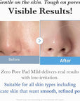 Medicube Zero Pore Pads Mild 2.0 (70 units) - Gentle Calming Toner Pads for Exfoliation, Minimizing Pores, and Blackhead Removal with PHA - Ideal for All Skin Types - Korean Skin Care