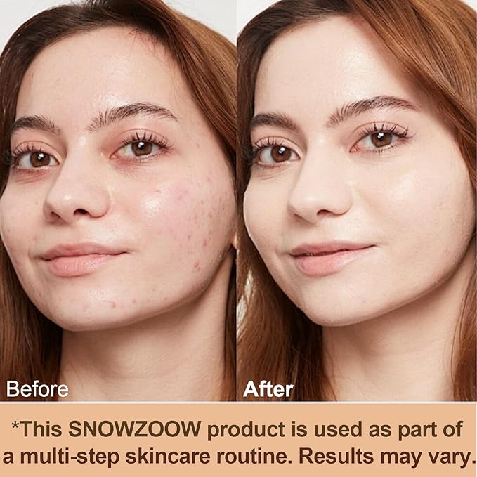 4 in 1 foundation Liquid- Hydrating Medium full coverage concealer with，SPF 50+