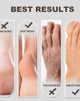60% Urea Foot & Hand Cream with 2% Salicylic Acid - Intensive Moisturizer for Dry, Cracked Heels, Feet, Elbows, Hands and Knees - Callus Remover lotion with Jojoba Oil, Avocado Oil & Aloe Vera, 7 oz