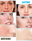 40 pads turmeric cleansing pads