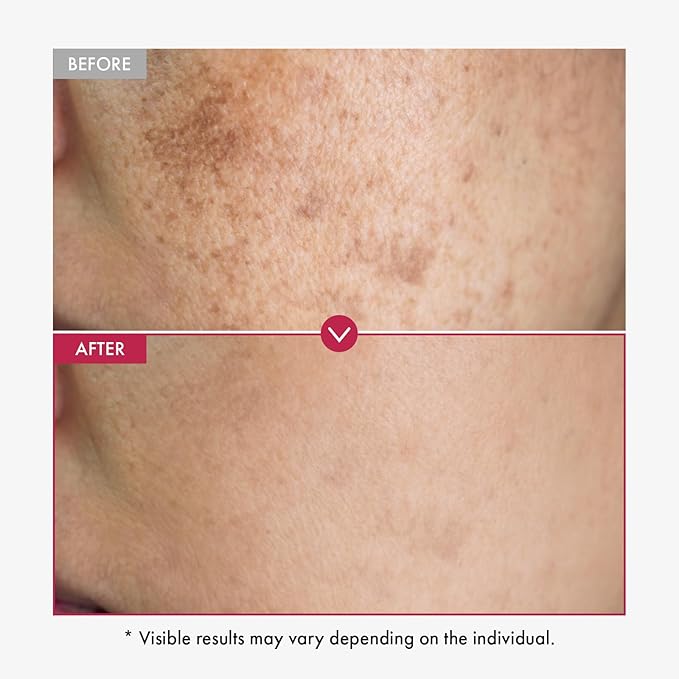 TOSOWOONG Niacinamide 10% + Tranexamic Acid 4% Serum, Arbutin 2%, Hyaluronic Acid, TXA Facial Serum, Glass Skin, Clarifying, Radiant Complexion with Natural Color, Korean Skin care, 33ml, 1.11 fl.oz.