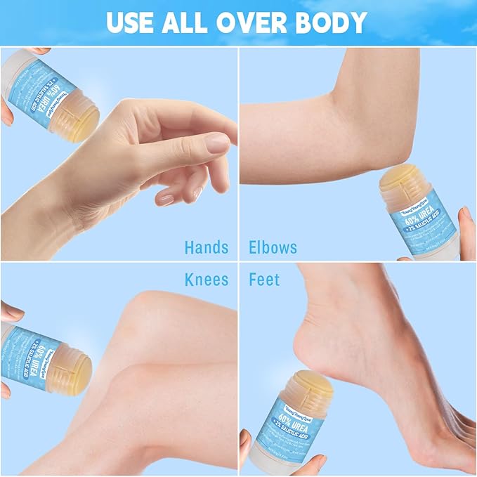 Urea Cream 60% with 2% Salicylic Acid Foot & Hand Cream Stick - Repair Balm for Cracked Hands, Elbows, Knees, Feet & Heels, Calluses and Exfoliation, Hydrates & Softens Dry Skin, 1.41 oz (1)