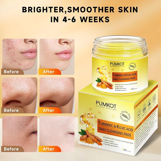 Turmeric Kojic Acid Cleansing Pads, Turmeric Face Scrub Pads Enriched with Kojic Acid, 60PCS