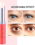 Retinol Under Eye Stick Balm: Cooling Eye Cream for Dark Circles Fine Lines Puffiness, Anti Wrinkle Hydrating Face Skincare in 3-4 Weeks