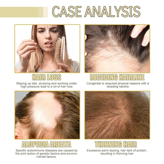 180ML Natural Hair Growth, Rosemary Oil for Hair Growth Organic, Rosemary Oil for Dry Damaged Hair and Growth Thin Hair （3PCS）