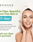 Exposed Skin Care Acne Facial Cleanser Clarifying