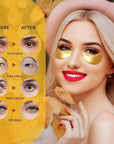 Under eye patches for puffy