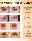 Under Eye Patches with Vitamin C & Caffeine 30 Pairs for Dark Circles, Fine Lines and Puffiness, with Niacinamide Hydra-Gel Collagen, Skin Care for Men & Women
