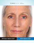 Serious Skincare INSTA-TOX Instant Wrinkle Smoothing Serum - Improves appearance of Fine Lines & Wrinkles - Temporary Skin Tightener - Instant Line Filler - Two .75 Fl Oz Tubes (2Pack)