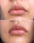 Talika Smile Patch | New Hydrating Lips
