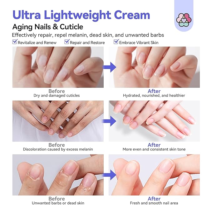 SAVILAND Ultra-Repairing Cuticle Cream: 20ml Organic Black Castor Oil Vitamin E Cuticle Softener for Deep Hydration Nail Care Aging Damaged Dry Cuticles Repair Nail Strengthener Home