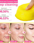 Turmeric kojic acid cleansing pads,