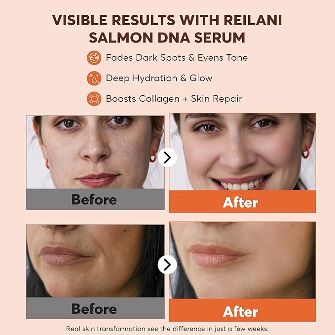 PDRN Salmon DNA Serum – Anti-Aging Face Serum with Hyaluronic Acid, Tripeptide & Vitamins (10,000ppm) – Hydrating Facial Serum for Blemishes, Collagen Boost & Fine Lines – Korean Skincare – 1 Fl Oz