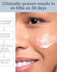 Clarifying Toner for Acne and Blemishes,