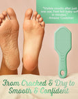 Silicone Foot Callus Remover - Nano Glass Foot File for Dead Skin and Cracked Heels - Callus Remover for Feet & Hard Skin - Ergonomic Foot Scrubber & Exfoliator for Soft, Smooth Feet - Green