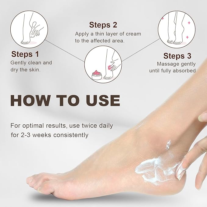 60% Urea Foot & Hand Cream with 2% Salicylic Acid - Intensive Moisturizer for Dry, Cracked Heels, Feet, Elbows, Hands and Knees - Callus Remover lotion with Jojoba Oil, Avocado Oil & Aloe Vera, 7 oz