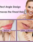 Gurelax Hair Removal Epilator for Women, Rechargeable Facial Epilator Hair Remover, 2-in-1 Electric Epilator & Shaver, 18 Carat Gold Plated Head, All Ages and Skin Types