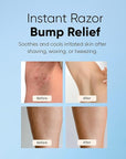 ESTETIST Razor Bump Solution Roll-On, Ingrown Hair & Razor Burn Care Serum, After Shave Roller for Bikini Area, Face, Neck, Underarm & Legs, Skin-Soothing Post Shave Care