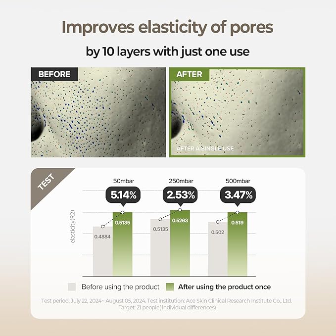 SKINFOOD Rice Serum, 48 Hours Fermented Rice Water Skincare Korean Serum for Face, Korean Rice Skincare for Natural Glow Glass Skin, Pore Minimizer, Rice Water Bright, 55ml/1.86fl.oz.